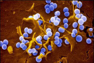 a microscopic view of the MRSA organism